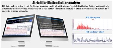 Holter Monitoring Analysesysteme